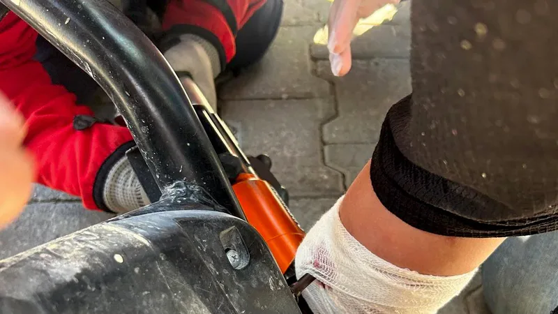Balıkesir Burhaniye'de elektrikli bisiklet kazasında pedal saplanan çocuk, itfaiye ekiplerinin