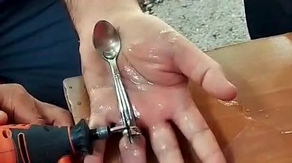 Gönen ilçesinde parmağına yüzük sıkışan vatandaş, kendi imkânlarıyla çıkaramayınca Balıkesir